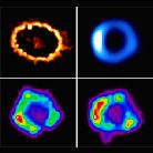 SN 1987 A images